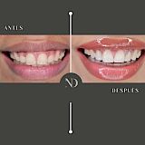 Diseño de Sonrisa