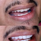 Rehabilitación Oral