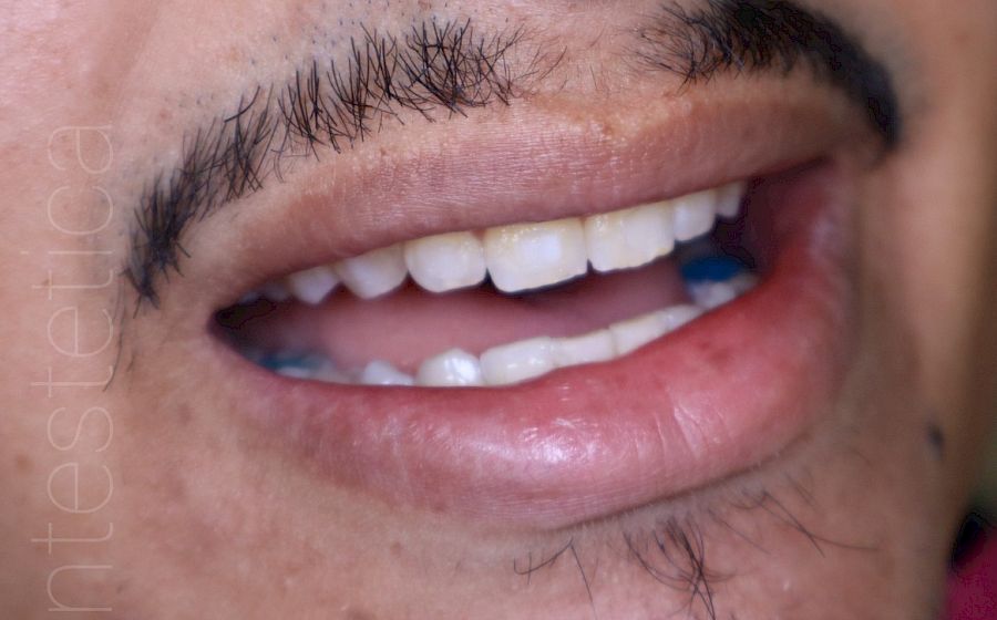 Rehabilitación Oral