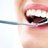 Rehabilitación Oral