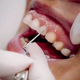 Periodoncia