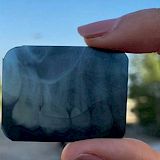 Radiografia Periapical