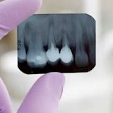 Radiografia Periapical