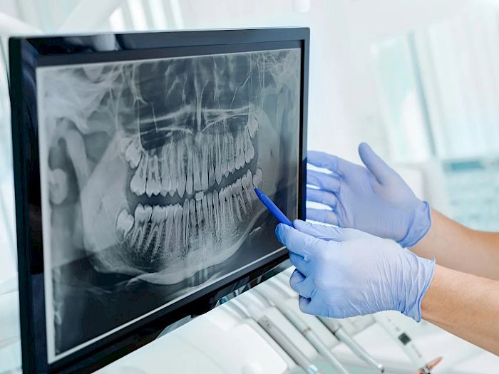 NovaDent - Odontología Clínica dental en la chorrera Nuestros trabajos