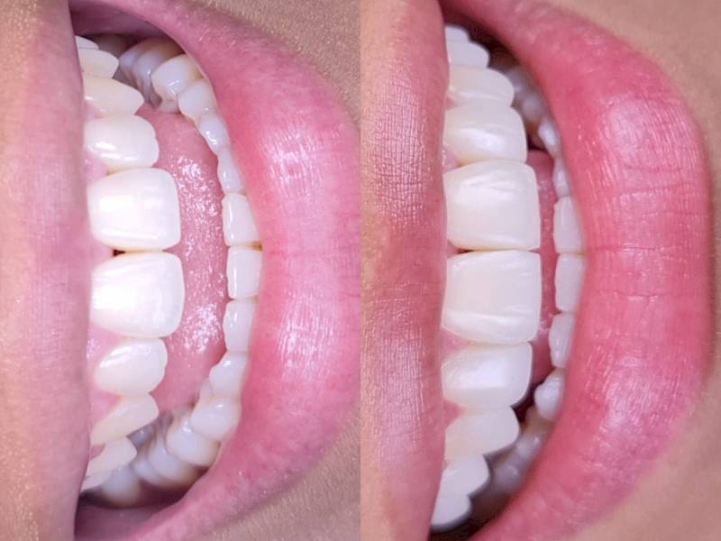 NovaDent - Odontología Clínica dental en la chorrera