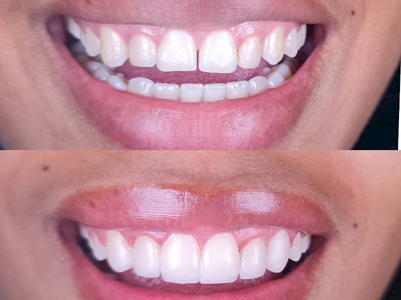 NovaDent - Odontología Clínica dental en la chorrera