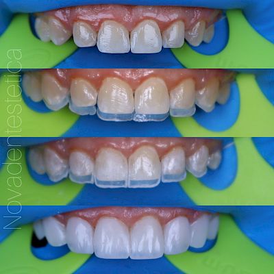 NovaDent - Odontología Clínica dental en la chorrera