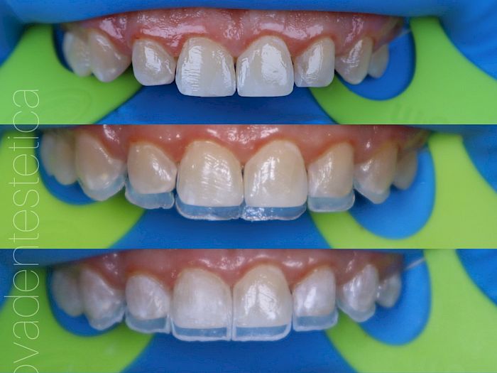 NovaDent - Odontología Clínica dental en la chorrera Nuestros trabajos