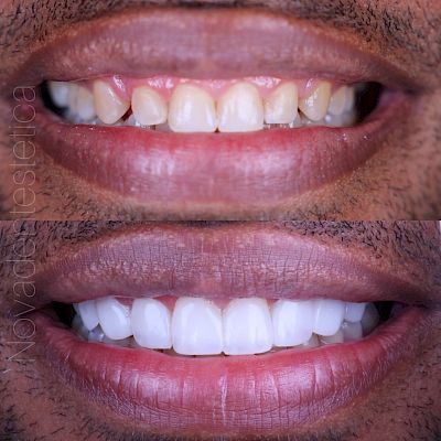 NovaDent - Odontología Clínica dental en la chorrera