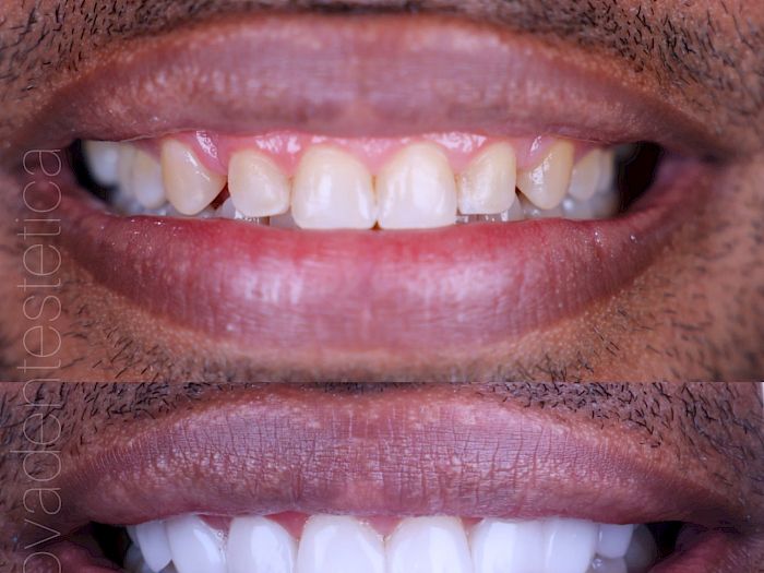NovaDent - Odontología Clínica dental en la chorrera Nuestros trabajos