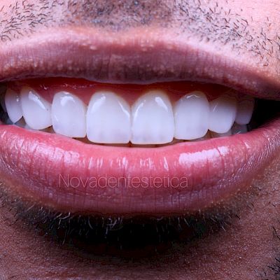 NovaDent - Odontología Clínica dental en la chorrera
