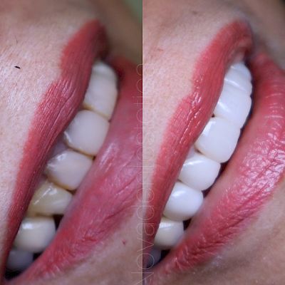 NovaDent - Odontología Clínica dental en la chorrera