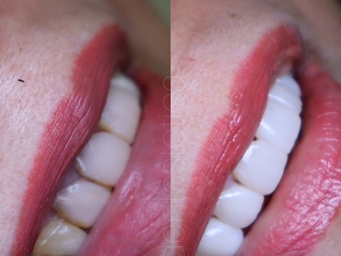 NovaDent - Odontología Clínica dental en la chorrera Nuestros trabajos