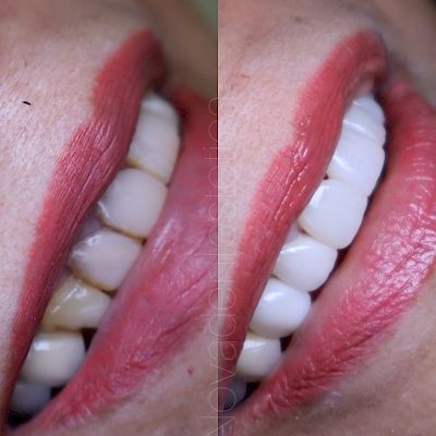 NovaDent - Odontología Clínica dental en la chorrera