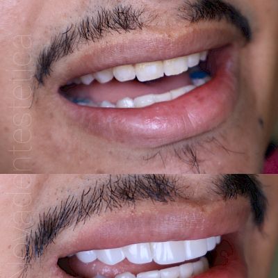 NovaDent - Odontología Clínica dental en la chorrera