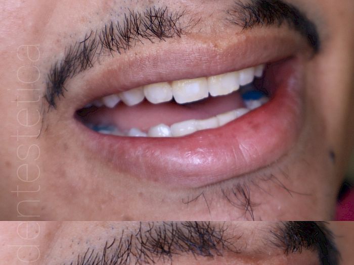 NovaDent - Odontología Clínica dental en la chorrera Nuestros trabajos