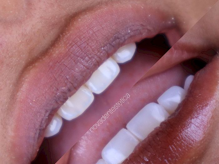 NovaDent - Odontología Clínica dental en la chorrera Nuestros trabajos