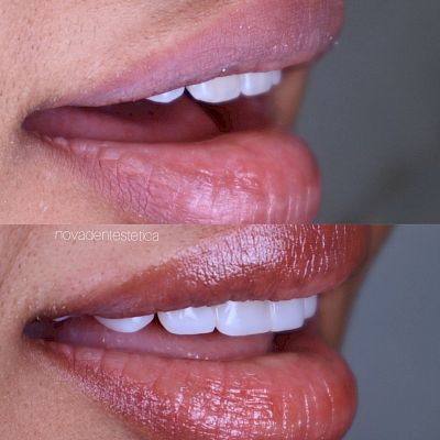 NovaDent - Odontología Clínica dental en la chorrera
