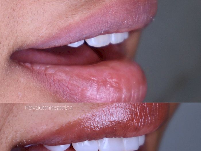 NovaDent - Odontología Clínica dental en la chorrera Nuestros trabajos