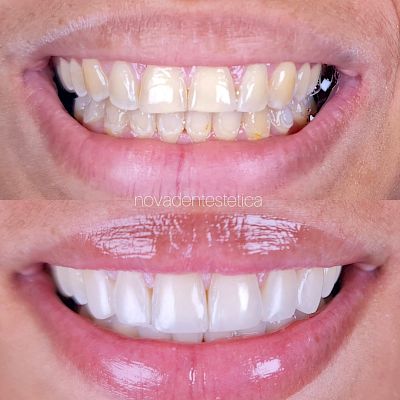 NovaDent - Odontología Clínica dental en la chorrera