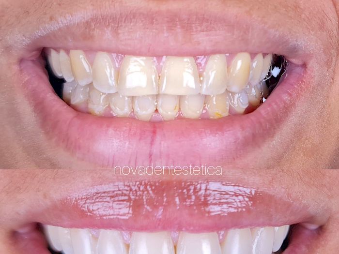 NovaDent - Odontología Clínica dental en la chorrera Nuestros trabajos