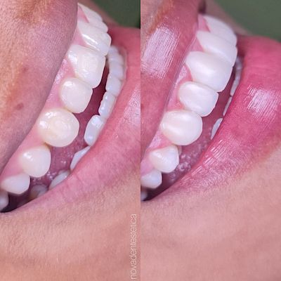 NovaDent - Odontología Clínica dental en la chorrera