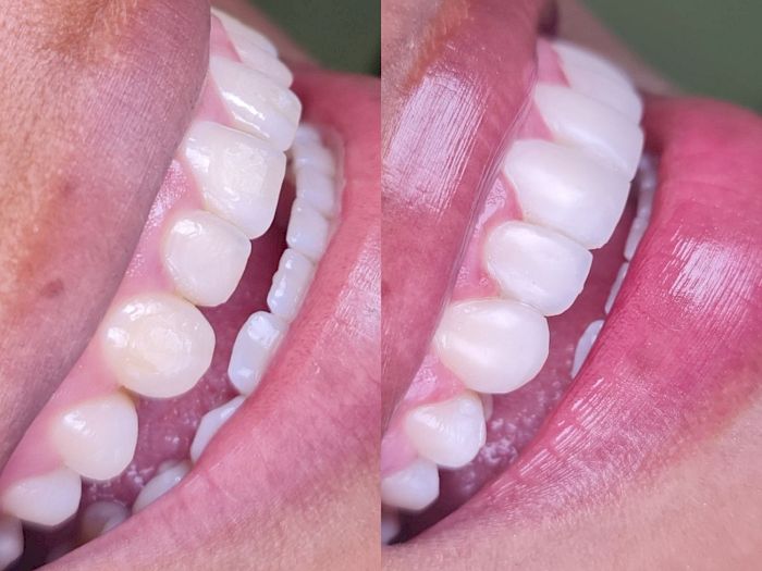 NovaDent - Odontología Clínica dental en la chorrera Nuestros trabajos