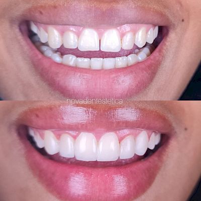 NovaDent - Odontología Clínica dental en la chorrera