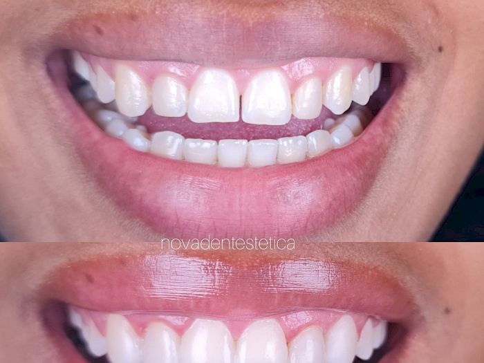 NovaDent - Odontología Clínica dental en la chorrera Nuestros trabajos