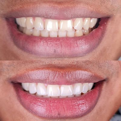 NovaDent - Odontología Clínica dental en la chorrera