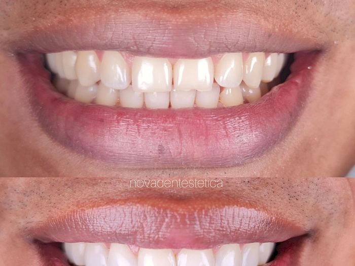 NovaDent - Odontología Clínica dental en la chorrera Nuestros trabajos