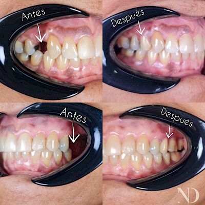 NovaDent - Odontología Clínica dental en la chorrera