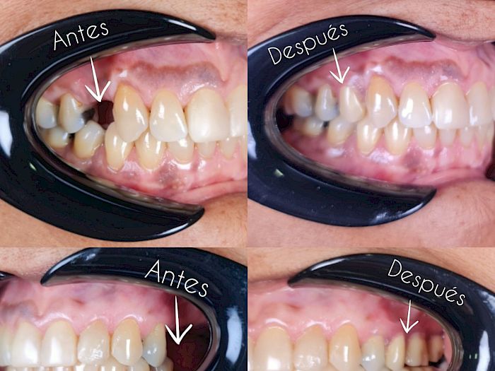 NovaDent - Odontología Clínica dental en la chorrera Nuestros trabajos