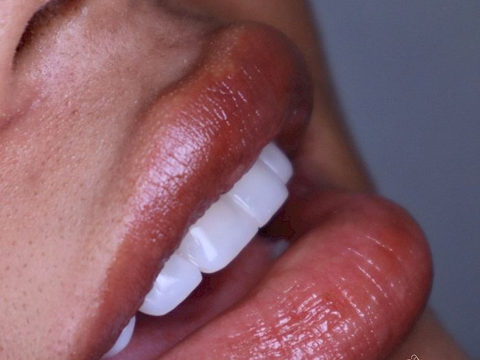 NovaDent - Odontología Clínica dental en la chorrera Nuestros trabajos