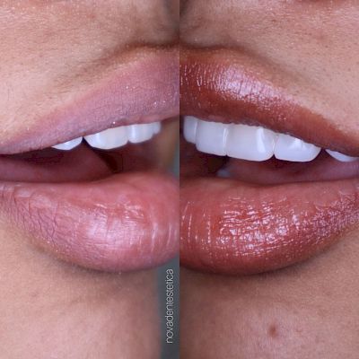 NovaDent - Odontología Clínica dental en la chorrera