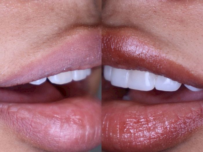 NovaDent - Odontología Clínica dental en la chorrera Nuestros trabajos