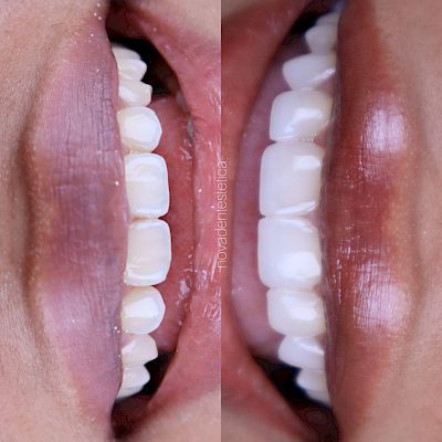 NovaDent - Odontología Clínica dental en la chorrera