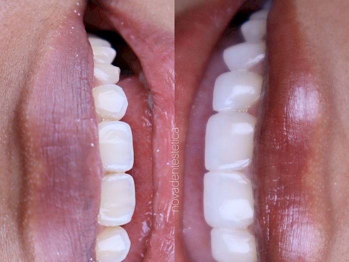 NovaDent - Odontología Clínica dental en la chorrera Nuestros trabajos