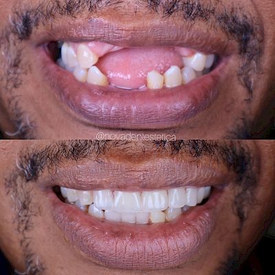 NovaDent - Odontología Clínica dental en la chorrera