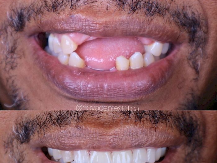 NovaDent - Odontología Clínica dental en la chorrera Nuestros trabajos