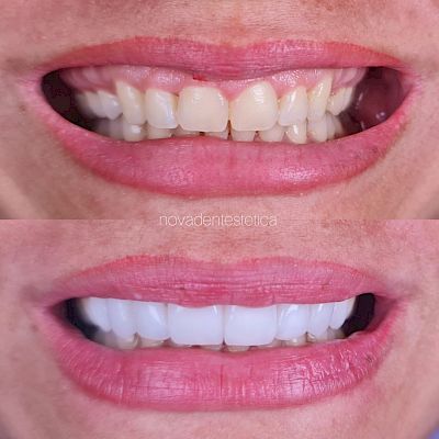 NovaDent - Odontología Clínica dental en la chorrera