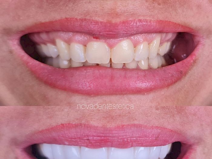 NovaDent - Odontología Clínica dental en la chorrera Nuestros trabajos